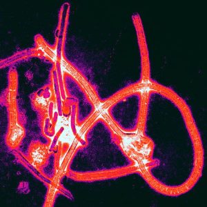 Ebola © Thomas W. Geisbert, Boston University School of Medicine